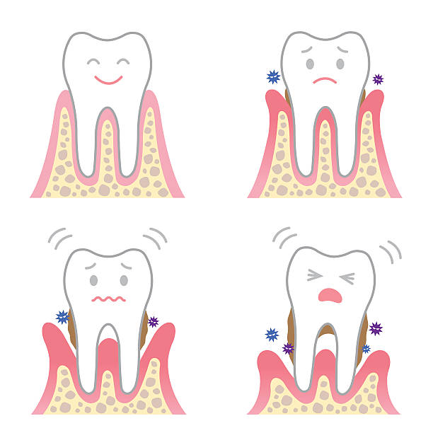 歯周病は健康を害する第一歩になるので、口腔ケアに取り組み歯周病にならないように歯磨きをしましょう。
